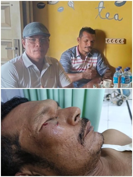 Ketua Gakorpan Riau Kutuk Keras Penganiayaan Wartawan oleh Mafia Tambang Emas Ilegal di Kuansing