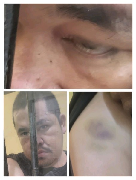 Tahanan Polres Pelalawan Diduga Dianiaya, KNPI Riau Desak Mabes Polri Turun Tangan
